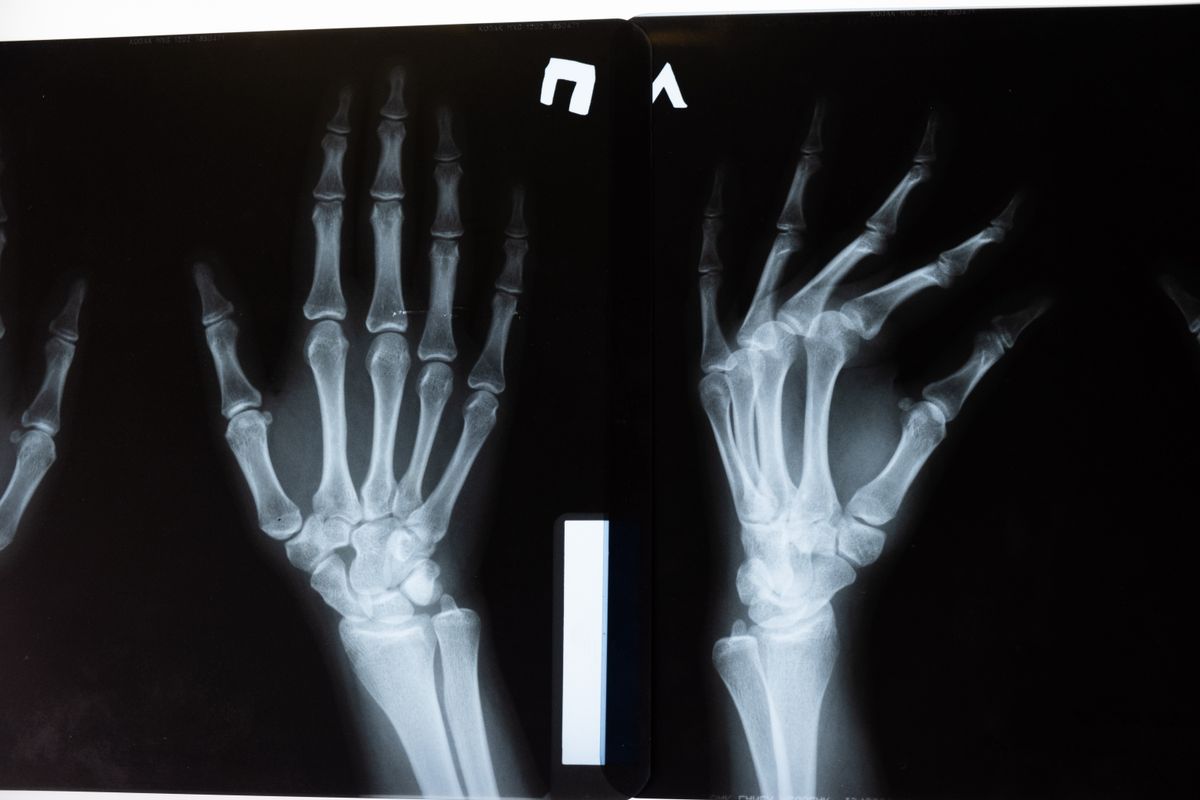 featured-bone